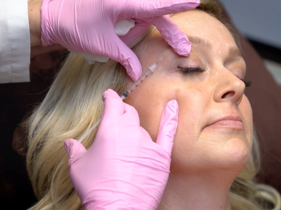 Close-up of a woman's face while she's receiving Dysport injections for crow's feet around the eyes.