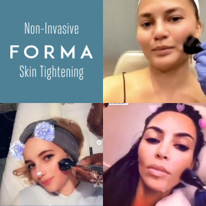 Instagram stories of celebrities Kim Kardashian, Chrissy Tiegan and Emma Roberts receiving Forma skin tightening facial.