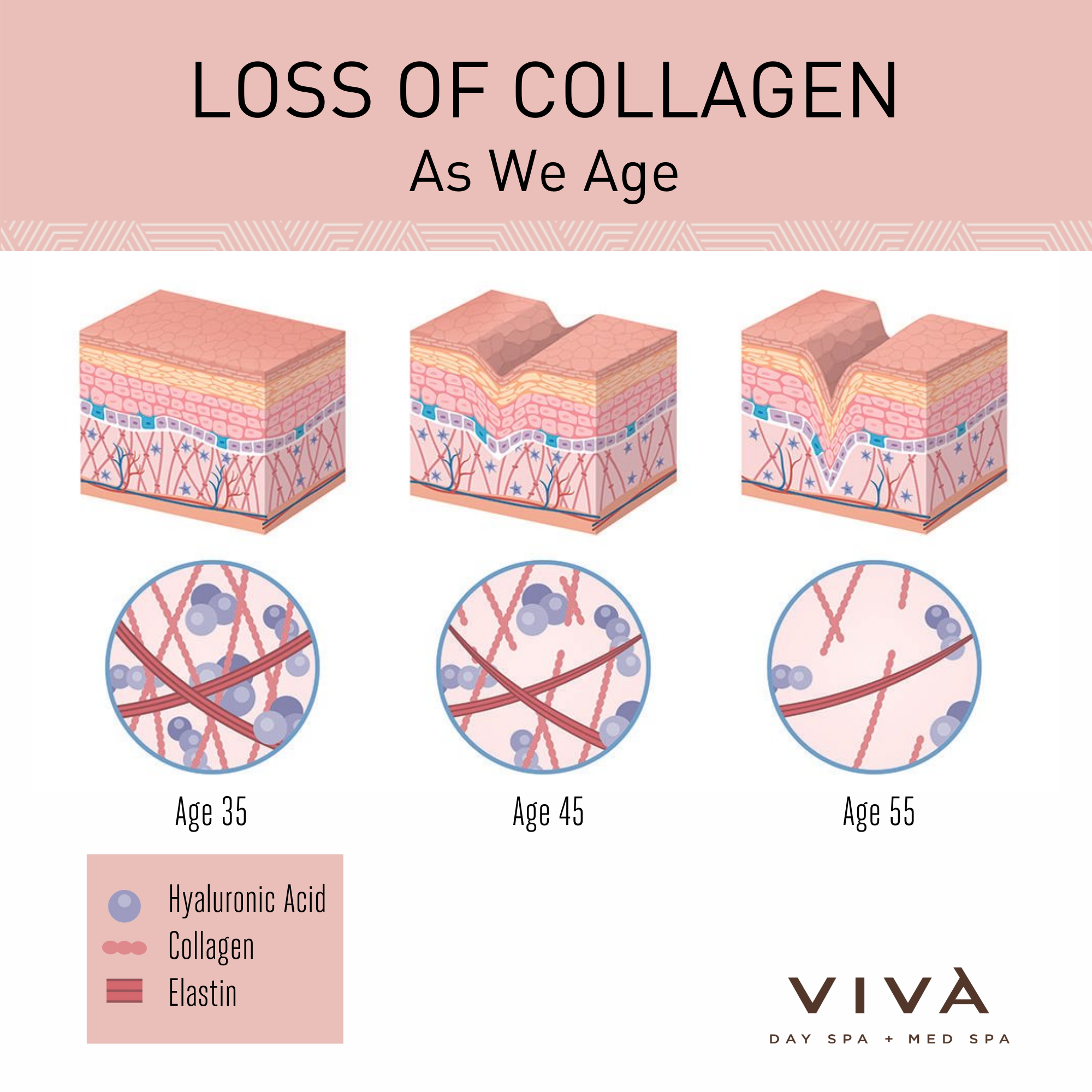 Illustration of collagen, elastin, and Hyaluronic Acid loss in our skin as we age over time.